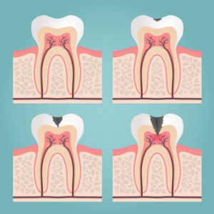 Thinkstock_480359541_neyro2008