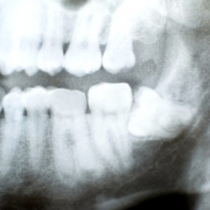 Thinkstock_Wojciech Krasnopolski_155673843