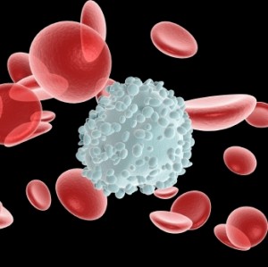 Tipos De Cancer En La Sangre Sintomas