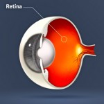 La pérdida visual puede deberse a la retinitis pigmentaria. ¿Sabes qué es?   