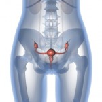 <!--:ES-->Las mujeres con cáncer del ovario a veces no reciben el tratamiento adecuado<!--:-->