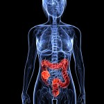 <!--:ES-->¿Estás en riego de desarrollar cáncer colorrectal?<!--:-->