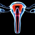 Nuevo medicamento contra los fibromas uterinos