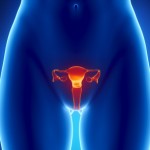 ¿Sabías que la endometriosis aumenta el riesgo de tres tipos de cáncer del ovario?