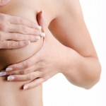 Se detectan nuevas claves genéticas sobre el cáncer de mama