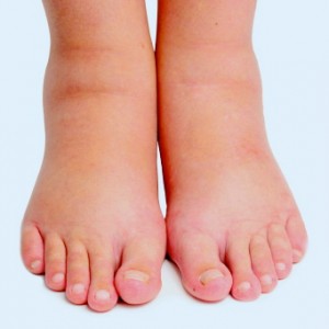 iStock_000018124365XSmall_happyfoto
