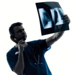 ¿Qué son los nódulos pulmonares?