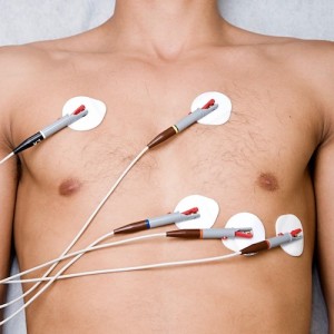 electrocardiograma