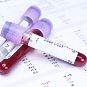 ¿Por qué se sube tu nivel de glucosa (azúcar) en la sangre ¿Por qué se sube tu nivel de glucosa (azúcar) en la sangre